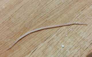 Сдать анализ кала на яйца гельминтов