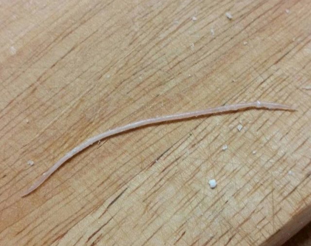 Благовещенец обнаружил в курином яйце огромного червя / Житель амурской столицы купил куриные яйца с неприятной начинкой. Внутри одного из них оказался червь длиной около 10 сантиметров. «Я хотел приготовить внучке сырники, разбил в творог домашнее яйцо, и из него выпал живой гельминт», — рассказал Алексей С. и прислал в редакцию подтверждающее фото.